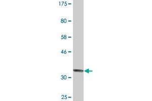 Western Blot detection against Immunogen (34. (RIMS2 anticorps  (AA 181-260))