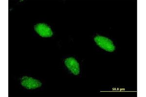 Immunofluorescence of monoclonal antibody to ARX on HeLa cell.