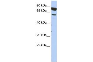 WB Suggested Anti-DPY19L4 Antibody Titration: 0. (DPY19L4 anticorps  (Middle Region))