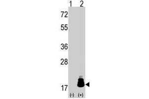 Western blot analysis of EIF4EBP1 (arrow) using rabbit EIF4EBP1 polyclonal antibody . (eIF4EBP1 anticorps  (Thr69))