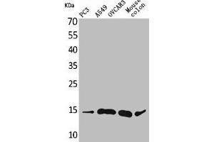 Western Blot analysis of PC-3 A549 OVCAR3 mouse colon cells using Eotaxin-3 Polyclonal Antibody (CCL26 anticorps  (Internal Region))