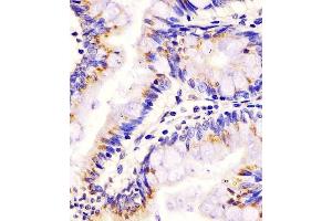 C staining PLA2G7 in human colon tissue sections by Immunohistochemistry (IHC-P - paraformaldehyde-fixed, paraffin-embedded sections).