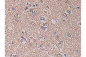 Detection of ADAM17 in Human Cerebrum Tissue using Monoclonal Antibody to A Disintegrin And Metalloprotease 17 (ADAM17)