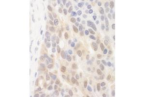 anti-Spermatogenesis Associated 2 (SPATA2) (AA 250-300) antibody
