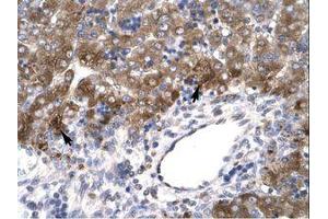 anti-Mesenchyme Homeobox 1 (MEOX1) (AA 38-87) antibody