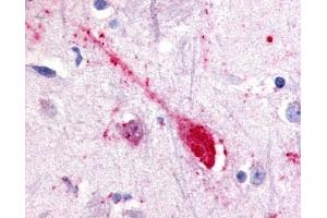 Immunohistochemical staining of Putamen (Neuron) using anti- GPR85 antibody ABIN122575 (GPR85 anticorps)