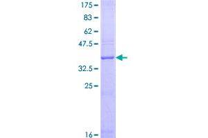 Image no. 1 for Receptor (G Protein-Coupled) Activity Modifying Protein 1 (RAMP1) (AA 1-148) protein (GST tag) (ABIN1317363)