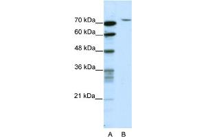 WB Suggested Anti-TAF6 Antibody Titration:  2. (TAF6 anticorps  (N-Term))
