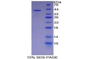 SDS-PAGE analysis of Pig Parathyroid Hormone Protein. (PTH Protéine)