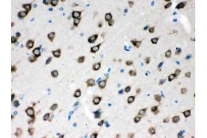 Anti-SMN1/2 Picoband antibody, (ABIN3043933),IHC(P)IHC(P): Rat Brain Tissue
