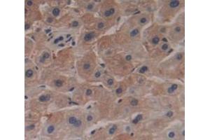 Used in DAB staining on fromalin fixed paraffin- embedded Kidney tissue