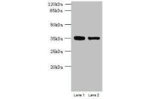 Western blot All lanes: MGME1 antibody at 1 μg/mL Lane 1: Jurkat whole cell lysate Lane 2: 293T whole cell lysate Secondary Goat polyclonal to rabbit IgG at 1/10000 dilution Predicted band size: 39 kDa Observed band size: 39 kDa (C20orf72 anticorps  (AA 81-260))