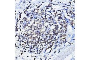 Immunohistochemistry of paraffin-embedded human lymph node using TP73 Rabbit pAb (ABIN6133470, ABIN6149430, ABIN6149431 and ABIN6213831) at dilution of 1:100 (40x lens).