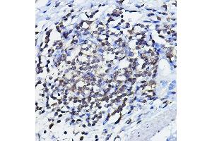 Immunohistochemistry of paraffin-embedded human lymph node using TP73 Rabbit pAb (ABIN6133470, ABIN6149430, ABIN6149431 and ABIN6213831) at dilution of 1:100 (40x lens). (Tumor Protein p73 anticorps  (AA 1-100))