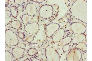 Immunohistochemistry of paraffin-embedded human thyroid tissue using ABIN7168238 at dilution of 1:100 (RNF11 anticorps  (AA 1-154))