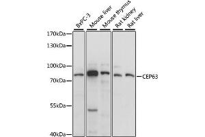 Western blot analysis of extracts of various cell lines, using CEP63 antibody (ABIN7266278) at 1:1000 dilution. (CEP63 anticorps  (AA 1-300))