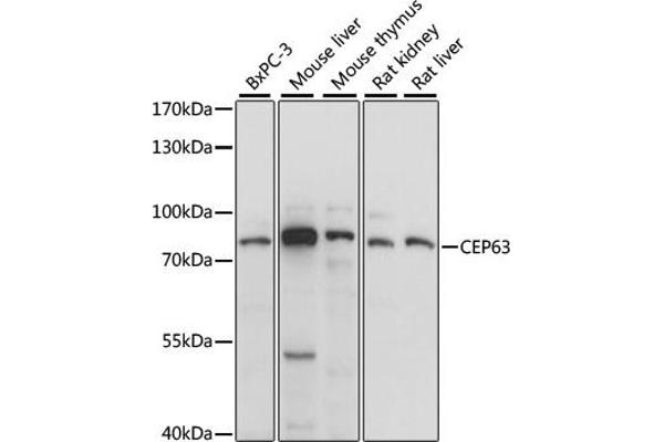 CEP63 抗体  (AA 1-300)