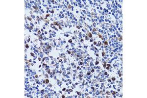 Immunohistochemistry of paraffin-embedded human tonsil using UHRF1 antibody (ABIN5971303) at dilution of 1/100 (40x lens). (UHRF1 anticorps)
