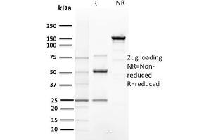 SDS-PAGE Analysis of Purified Cyclin E1 Mouse Recombinant Monoclonal Antibody ABIN6383795. (Cyclin E1 anticorps  (AA 10-176))