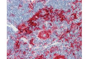 Anti-GSN / Gelsolin antibody IHC staining of human thymus.