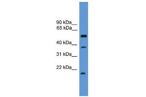 WB Suggested Anti-SPINT2 Antibody Titration: 0. (SPINT2 anticorps  (Middle Region))