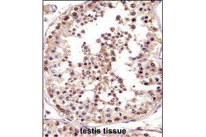 Immunohistochemistry (Formalin/PFA-fixed paraffin-embedded sections) of human testis tissue with LOC728137 polyclonal antibody  followed by peroxidase conjugation of the secondary antibody and DAB staining. (TSPY3 anticorps  (AA 274-303))