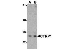 Western Blotting (WB) image for anti-C1q and Tumor Necrosis Factor Related Protein 1 (C1QTNF1) (Middle Region) antibody (ABIN1030910) (C1QTNF1 anticorps  (Middle Region))