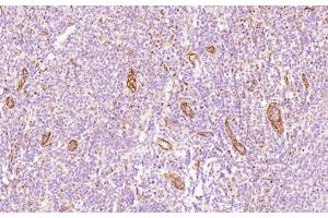 Immunohistochemical analysis of paraffin-embedded Human tonsil section using Pink1 (ABIN658983 and ABIN2838032). (CD34 anticorps  (AA 185-214))