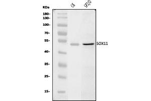 Western blot analysis of Sox11 using anti-Sox11 antibody (ABIN7599308).