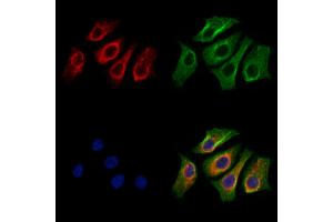 ABIN7094406 and ABIN7098453 staining HepG2 cells by IF/ICC.