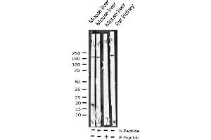 Western blot analysis of Phospho-HER4 (Tyr1284) expression in various lysates