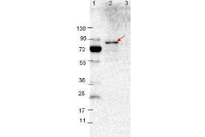 Western blot showing detection of 0. (VlsE anticorps)