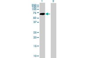 Western Blot analysis of CRTAM expression in transfected 293T cell line by CRTAM MaxPab polyclonal antibody. (CRTAM anticorps  (AA 1-393))