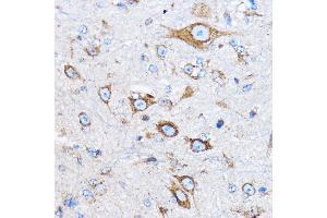 Immunohistochemistry of paraffin-embedded mouse brain using Cathepsin B Rabbit pAb (ABIN3021175, ABIN3021176, ABIN3021177 and ABIN6214050) at dilution of 1:100 (40x lens). (Cathepsin B anticorps  (AA 1-339))