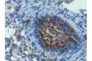 Detection of ANGPT2 in Mouse Lung Tissue using Polyclonal Antibody to Angiopoietin 2 (ANGPT2)