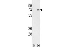 Western blot analysis of Ku70 antibody and 293 cell lysate (2 ug/lane) either nontransfected (Lane 1) or transiently transfected with the Ku70 gene (2). (XRCC6 anticorps  (AA 432-461))