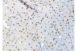 ABIN6264500 and ABIN6274041 at 1/100 staining Rat brain tissue by IHC-P. (PTBP2 anticorps  (Internal Region))