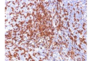 Formalin-fixed, paraffin-embedded human Tonsil stained with CD44 Mouse Monoclonal Antibody (156-3C11).