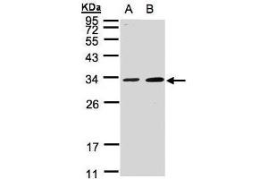 WB Image Sample(30 ug whole cell lysate) A:A431, B:MOLT4 , 12% SDS PAGE antibody diluted at 1:1000