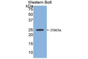 Western blot analysis of the recombinant protein. (SPRY2 anticorps  (AA 116-304))