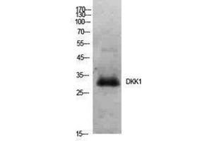 Western Blotting (WB) image for anti-Dickkopf Homolog 1 (DKK1) (Internal Region) antibody (ABIN3181416) (DKK1 anticorps  (Internal Region))