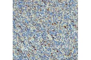 IHC analysis of PPA2 using anti-PPA2 antibody (ABIN6719431). (PPA2 anticorps  (AA 33-334))