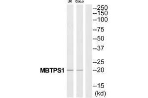 Western blot analysis of extracts from Jurkat/COLO205 cells, using MBTPS1 antibody. (MBTPS1 anticorps  (C-Term))