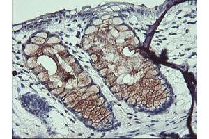 Image no. 3 for anti-ADP-Ribosylation Factor-Like 5B (ARL5B) antibody (ABIN1496721) (ARL5B anticorps)