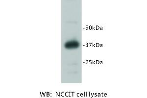 Image no. 1 for anti-RAS (RAD and GEM)-Like GTP Binding 2 (REM2) antibody (ABIN1112927)