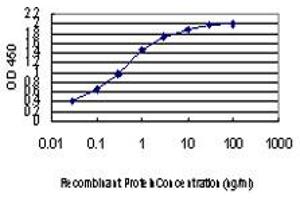 Detection limit for recombinant GST tagged EPSTI1 is approximately 0.
