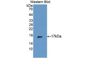 Detection of Recombinant PIP, Human using Polyclonal Antibody to Prolactin Induced Protein (PIP) (PIP anticorps  (AA 41-139))
