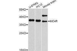 Western blot analysis of extracts of various cell lines, using MC4R Antibody (ABIN5998196) at 1/1000 dilution. (MC4R anticorps)