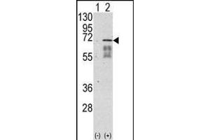 Western blot analysis of ACVR1 (arrow) using rabbit polyclonal ACVR1 Antibody (Center ) (ABIN391154 and ABIN2841264). (ACVR1 anticorps  (AA 138-170))