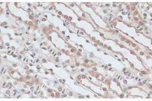 Immunohistochemistry of paraffin-embedded Mouse kidney using ZNF581 Polyclonal Antibody at dilution of 1:100 (40x lens). (ZNF581 anticorps)
